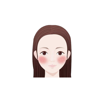 红血丝
