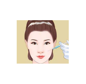 玻尿酸全脸填充